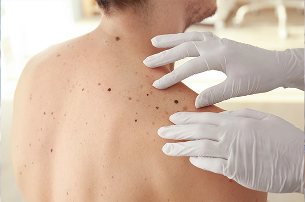 Consulta de dermatologia clínica
